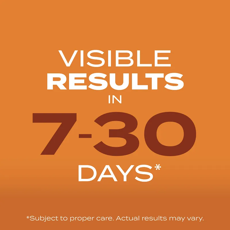 Scotts&reg; Turf Builder&reg; Grass Seed Bermudagrass image number 3.0